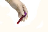Need For Free AIDS Clinics on the Rise