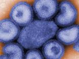 Swine Flu Fact or Fiction: You Ask, We Answer