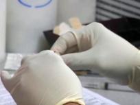 Dallas County Reports 2 More Swine Flu Deaths