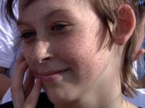 13-Year-Old Who Fought Rare Cancer Dies