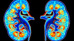 Free Kidney Health Screening