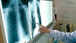 Edison Middle School Students Tested for TB