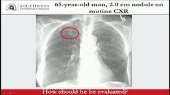 More Non-Smokers Are Being Diagnosed with Lung Cancer