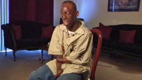 Man Without Hands Denied Six Flags Ride