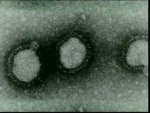 Private Company Offering H1N1 Shots