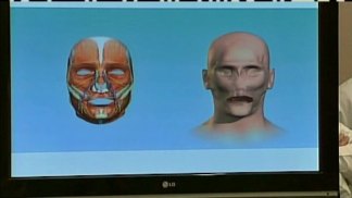 Doctor Explains Face Transplant Surgery