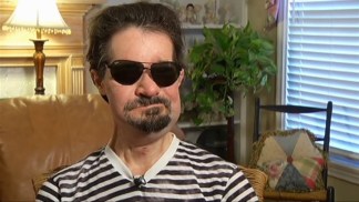 Face Transplant Recipient Smiles Again