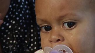 Baby Treated for TB