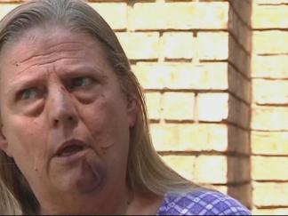 School Bus Driver: I Fell Off My Seat Before Crash