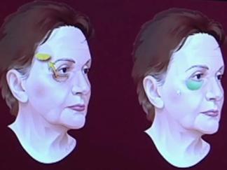 Avoid Cosmetic Remorse With Pre-Surgery Education