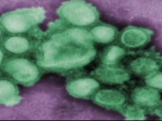Swine Flu Cases Could Spike Over Holidays