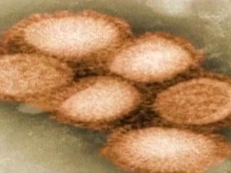 H1N1 Swine Flu Still Going Strong