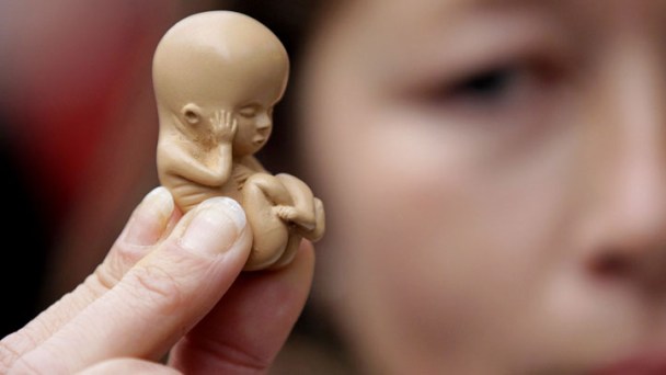 House Committee Mulls 20 Week Abortion Ban