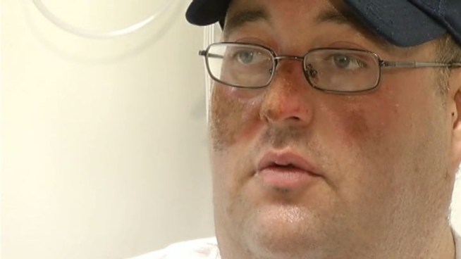 Eastland County volunteer firefighter Matt Clark is recovering at Parkland Hospital after narrowly escaping when flames engulfed his fire truck outside Gorman.