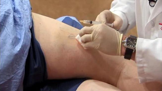 Federal regulators have recently approved a treatment for spider veins long used in Europe.