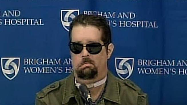 Dallas Wiens talked about his face transplant for the first time since the surgery.
