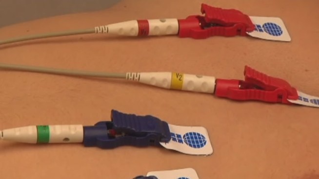 The Living for Zachary Foundation sponsored a mobile heart screening event Friday to look for heart abnormalities that lead to sudden cardiac arrest.