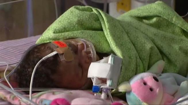 Born with hypoplastic left heart syndrome, 2-week-old Skylar Turner fights to grow stronger. She'll undergo two more sugeries by the time she's three years old.