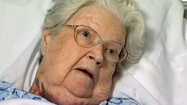 Cardiologists removed a 12-inch blood clot from an Arkansas woman's heart in the first complete clot removal of its kind in Texas.