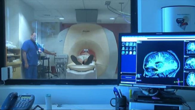 An advanced MRI scan that tracks the fibers of the brain is helping doctors track concussion damage.