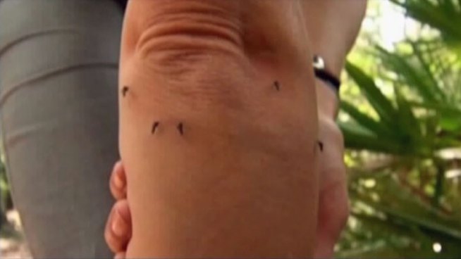 Fear of West Nile Virus has North Texans turning to professional and do-it-yourself remedies for mosquitoes.