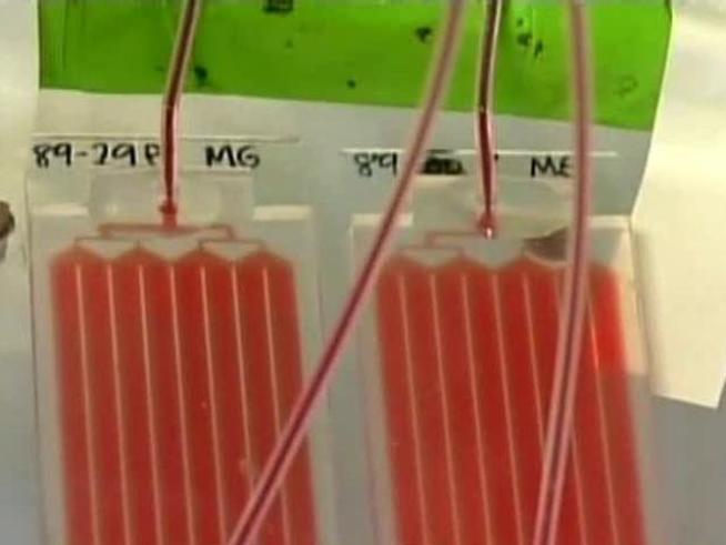 Doctors have high hopes for a test capable of detecting a single cancer cell among billions of healthy ones in a blood sample.
