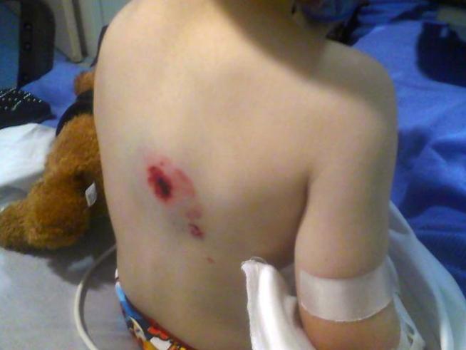 A driver and his 3-year-old son were injured in a two-county chase that ended in <a title=