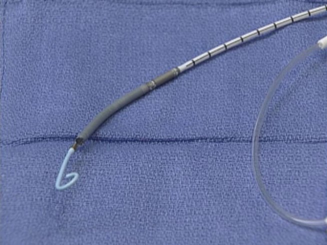 North Texas Doctors Use World's Smallest Heart Pump