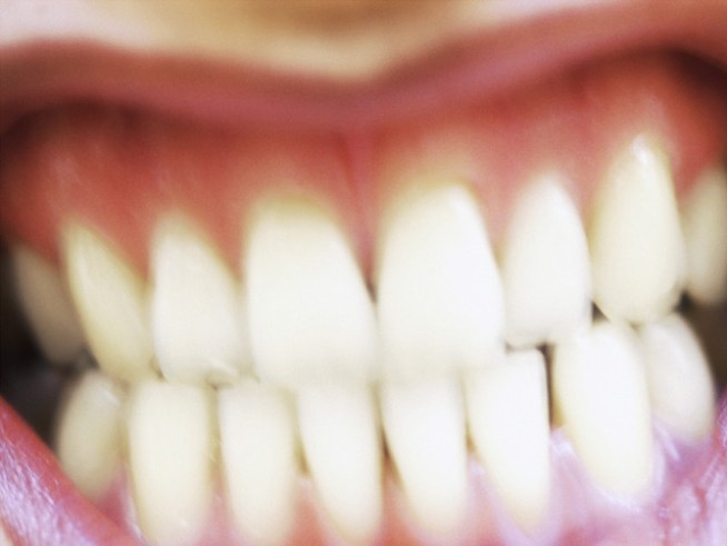 Lawsuit Filed Over Bad Breath