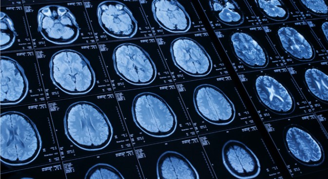 Stroke Treatment Window Widens