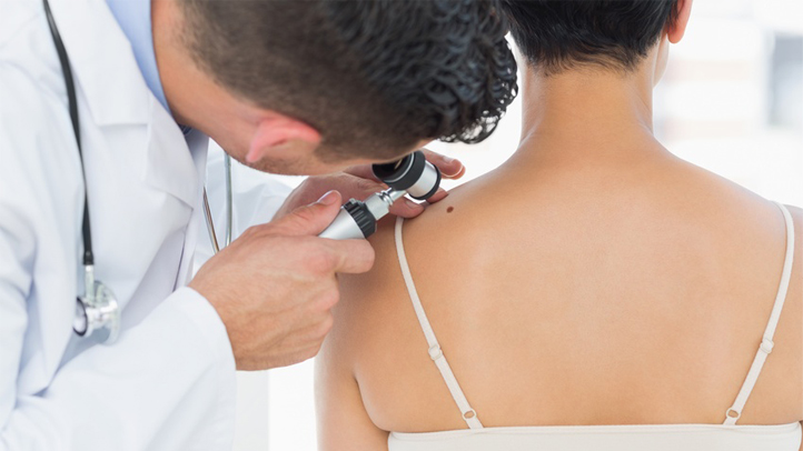 Dermatologist mole 2015