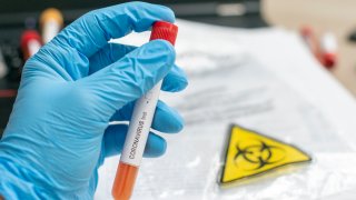 Close up of microbiologist hand with surgical gloves holding a blood test tube for coronavirus. Test tubes with blood sample for covid-19 virus, biohazard transportation bag