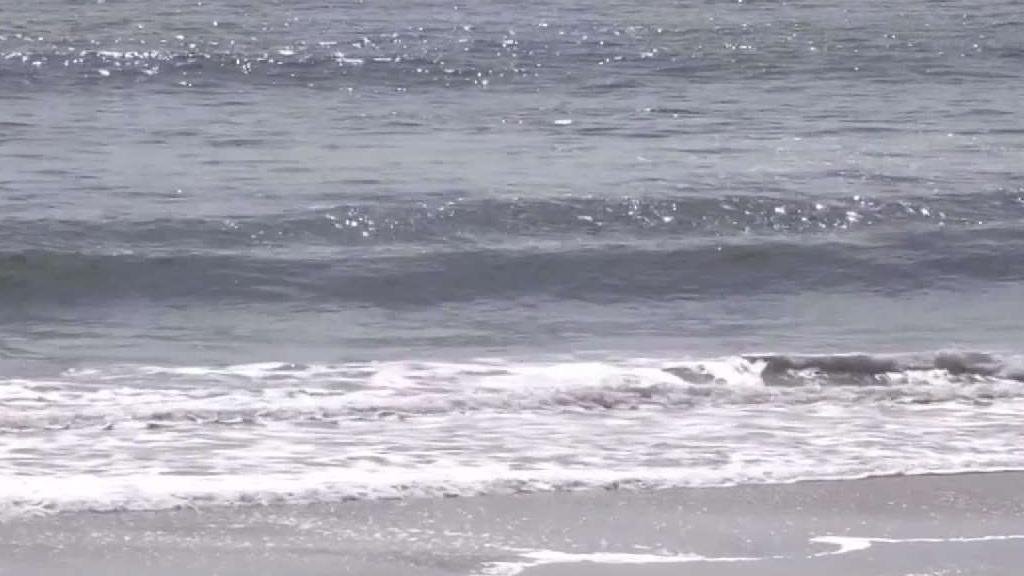 North Texas Woman Survives Florida Shark Attack – NBC 5 Dallas-Fort Worth - Vimarsana News