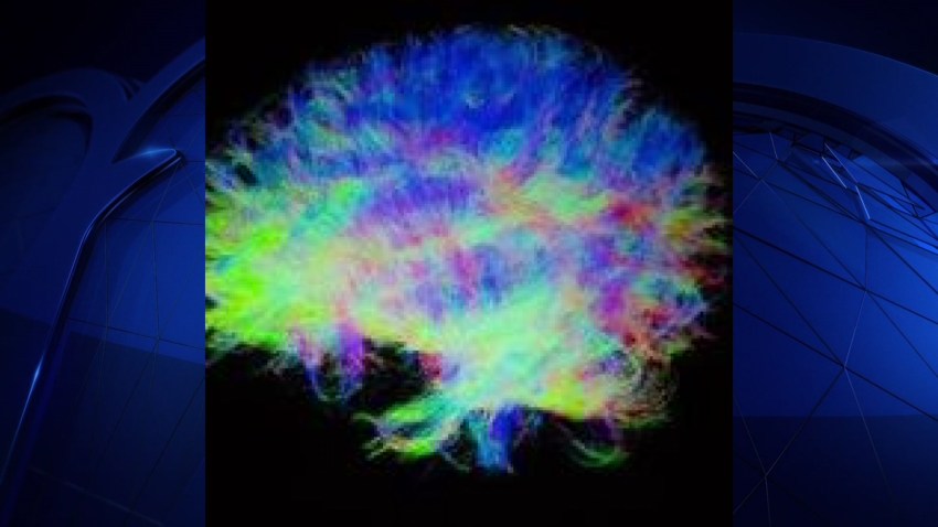 brain image