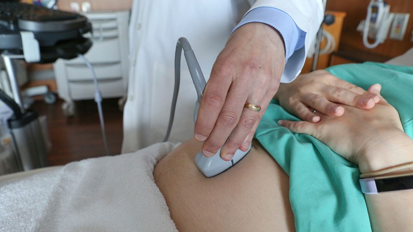 Pregnancy Deaths