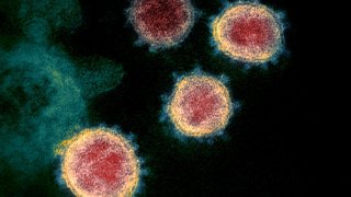 Colorized scanning electron micrograph of SARS-CoV-2, the novel coronavirus that causes COVID-19