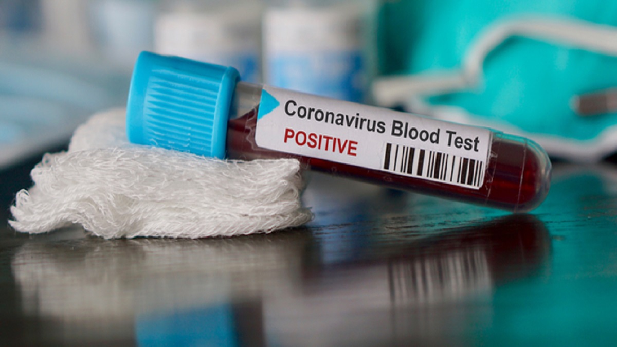 Coronavirus Testing: What does it look like? - NBC 5 ...