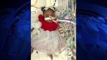 Tinslee Lewis, dressed for Christmas above, has been at Cook Children's Medical Center in Fort Worth, Texas since her premature birth.