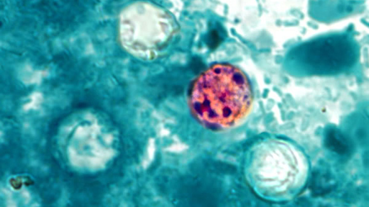 Stomach Bug Outbreak