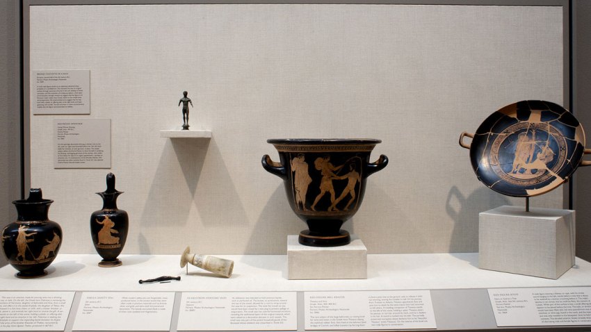 dma-spina-installation