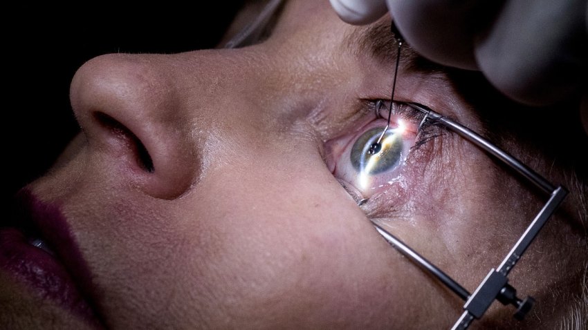 HealthBeat Eye Surgery