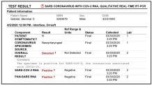 covid-19 positive test