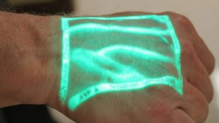 hand-vein-projection1