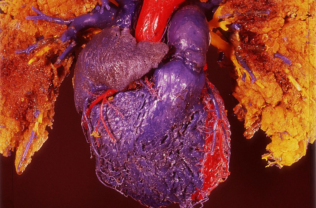 ‘Beating Heart in a Box’ Promises Major Revolution in Medical Care