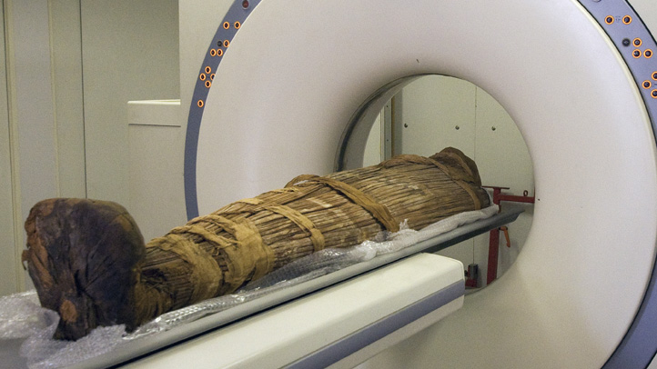 Egypt Mummies Heart Disease