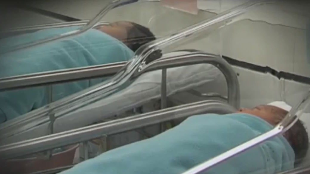 Researchers Developing Therapy for Infection Suffered by Preemies – NBC 5 Dallas-Fort Worth - Vimarsana News