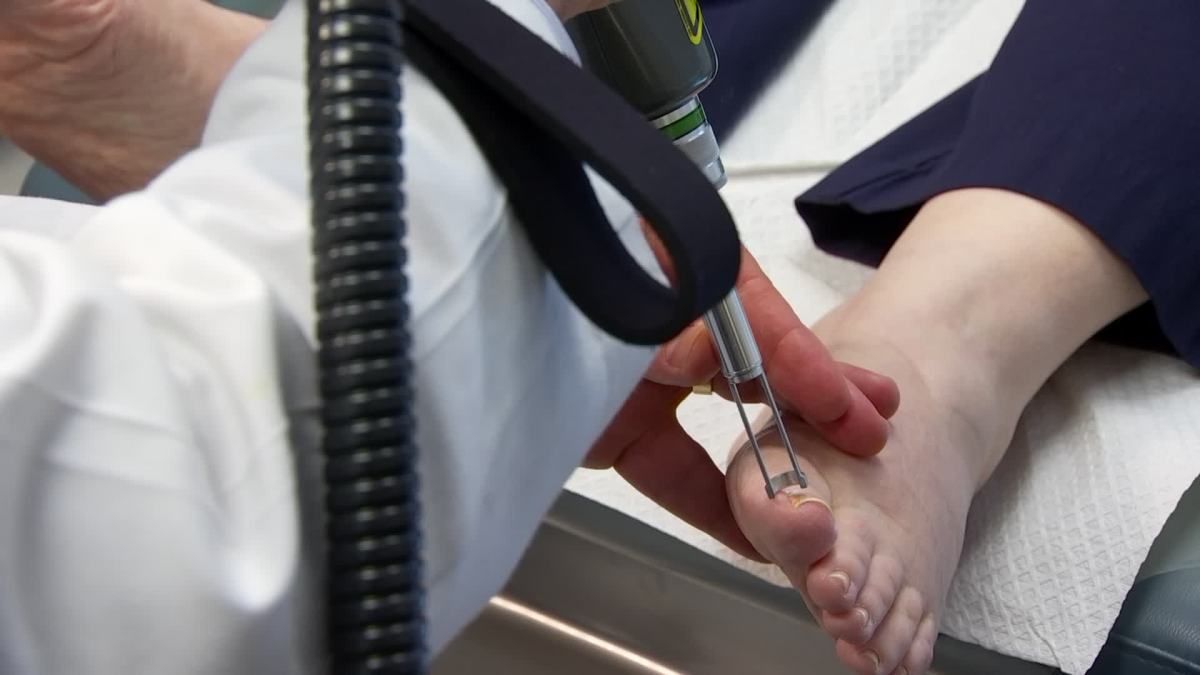 treating-toenail-fungus-with-lasers-nbc-5-dallas-fort-worth