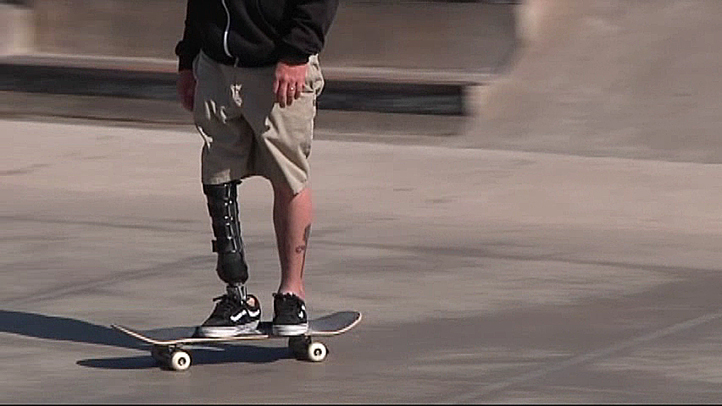 Amputee Skateboarder Hopes to Inspire Others With Disabilities – NBC 5 ...