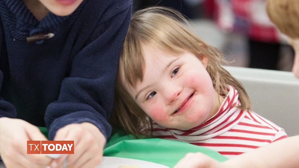 Bringing Awareness To Down Syndrome Nbc 5 Dallas Fort Worth Bringing Awareness To Down Syndrome Nbc 5 Dallas Fort Worth