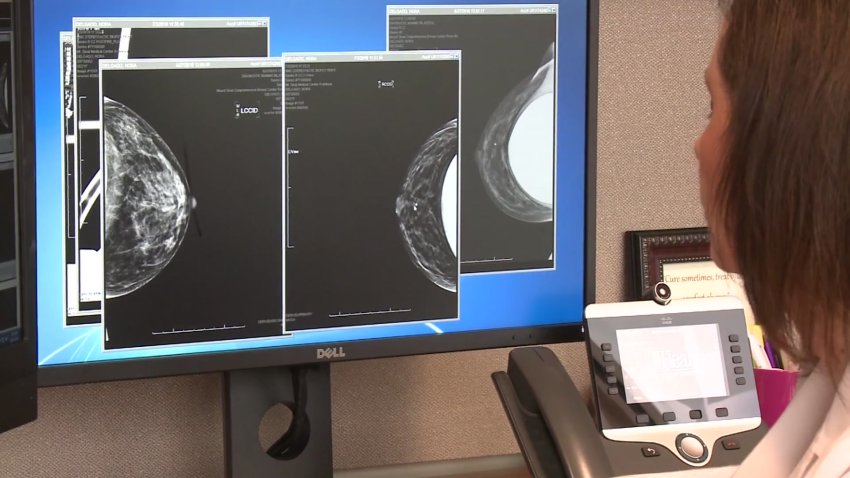 Why You Want to Share Your COVID-19 Vaccine Status When You Get a Mammogram